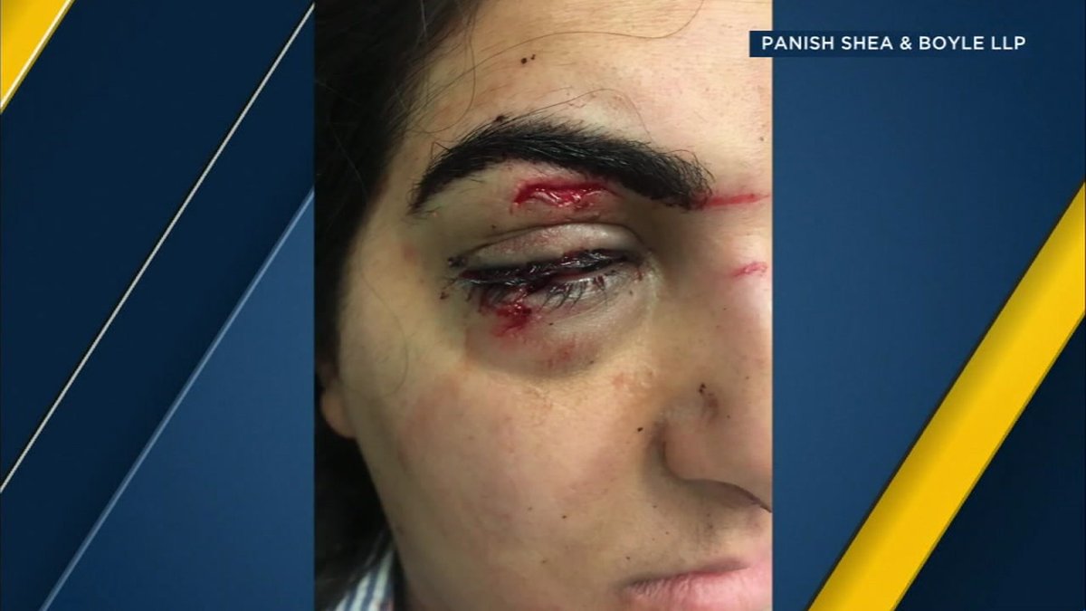 Woman injured in face by drone at Vegas casino light show
