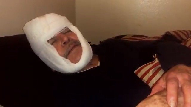66-year-old Las Vegas man fights off pistol-whipping home invaders    